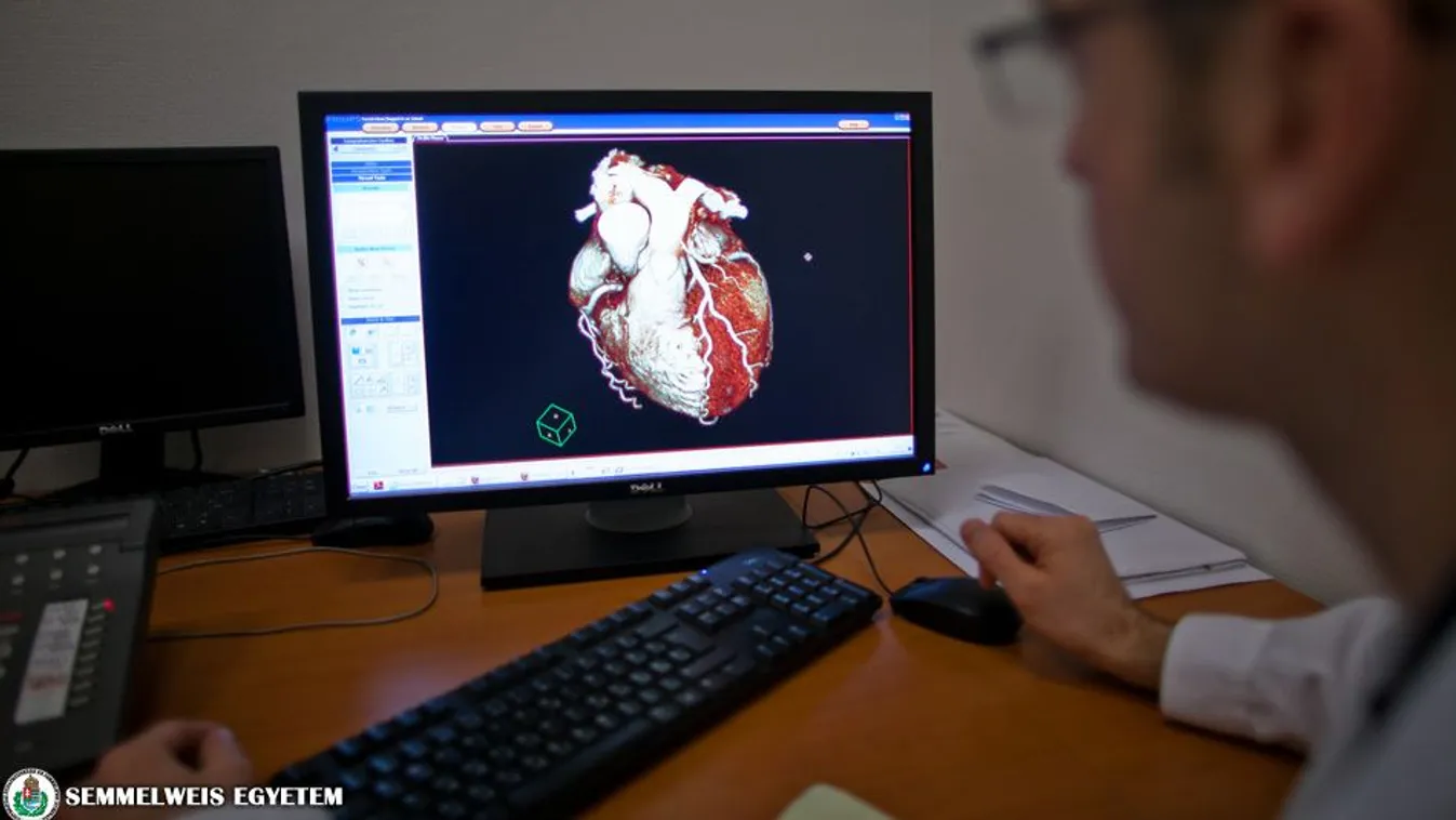 Így előzhetőek meg a koszorúér-betegségek