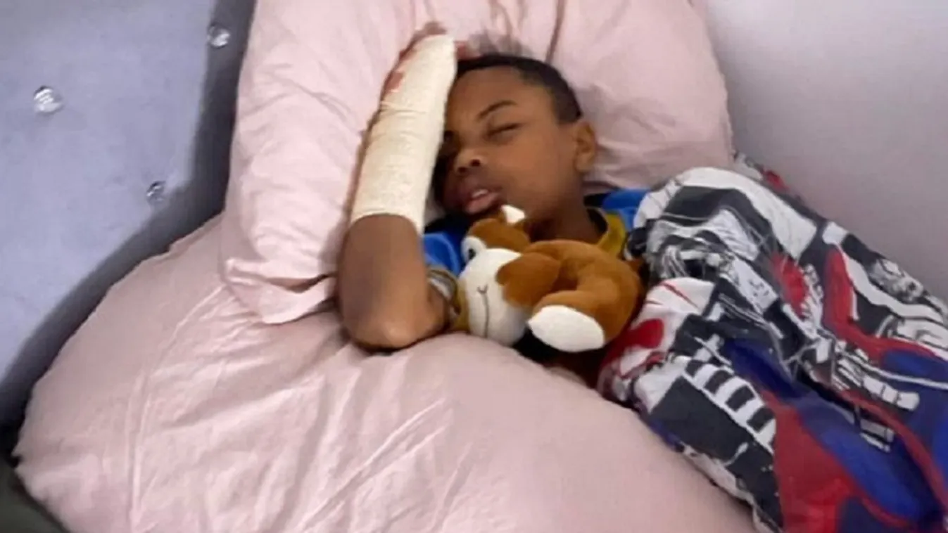 A 11 éves fiú menekülés közben elvesztette az ujjait