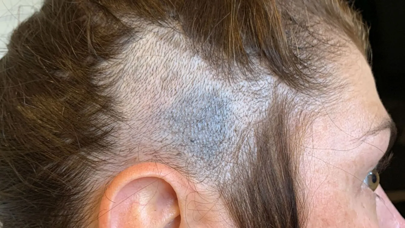 A fodrásza mentette meg az anyuka életét