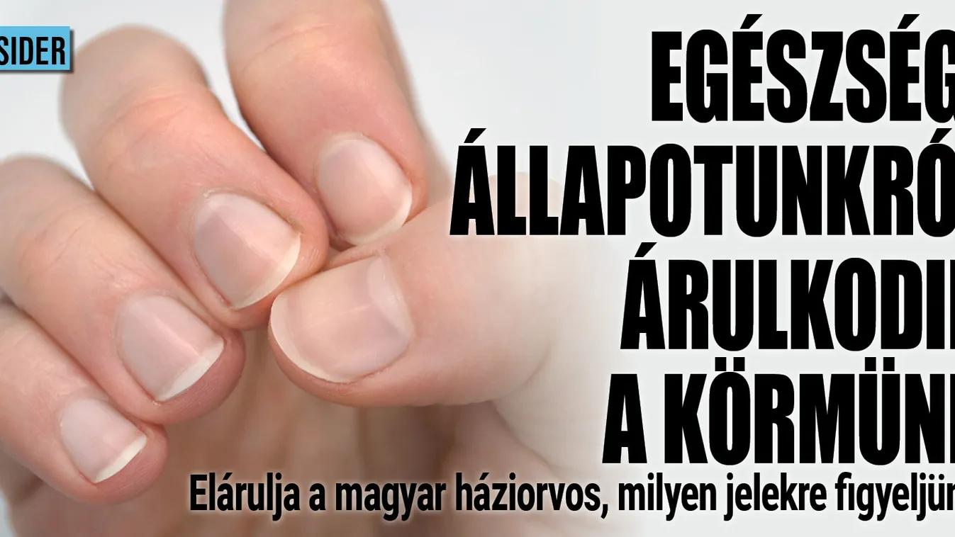 Magyar háziorvos: Egészségi állapotunkról árulkodik a köröm