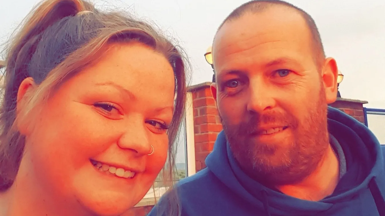  Ritka betegség kínozza a 29 éves nőt