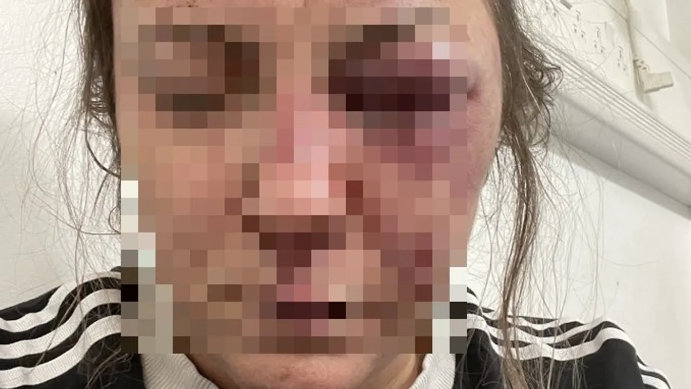 Brutálisan megverte a kisgyermekes anyát a párja