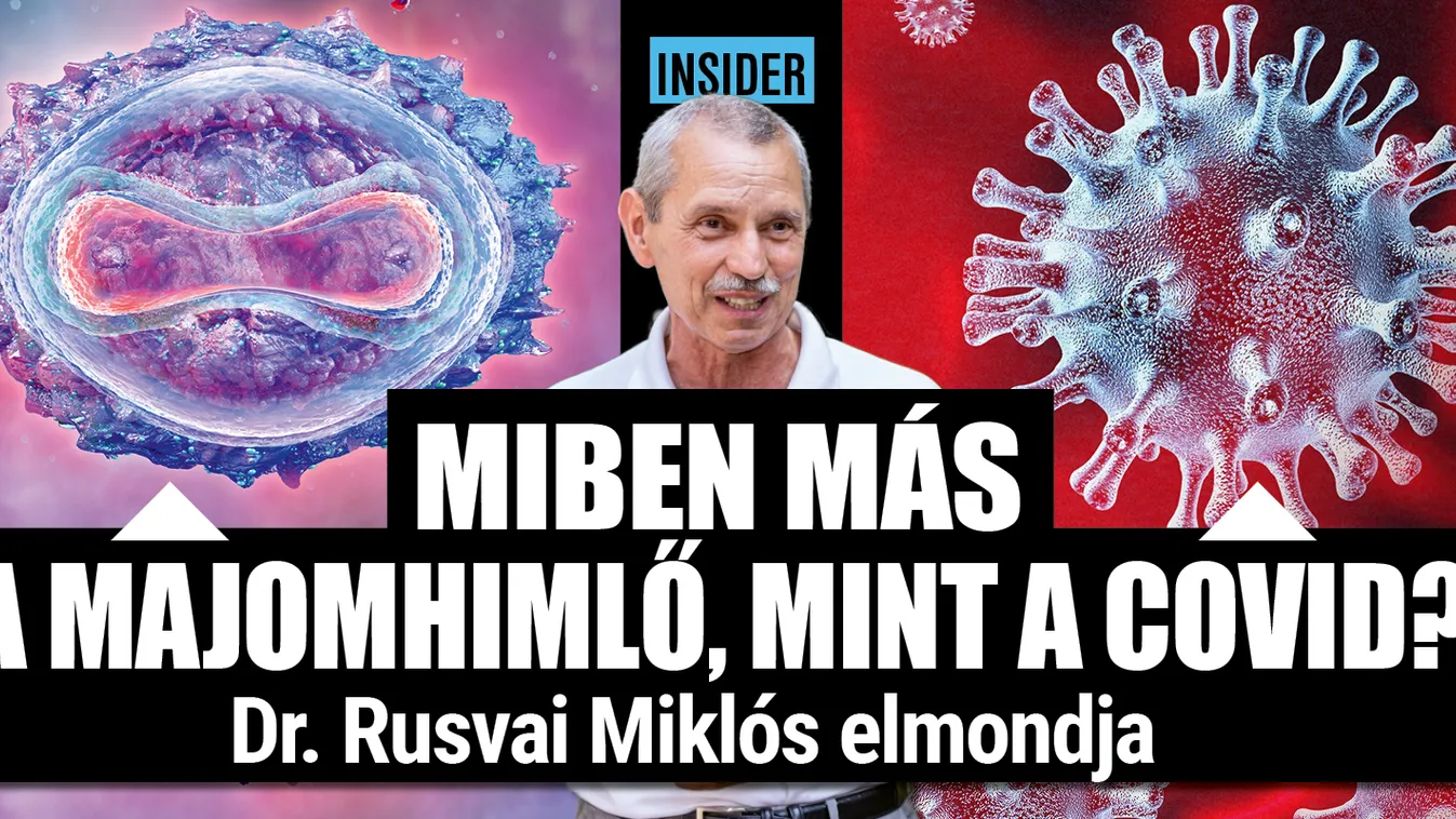 Dr. Rusvai Miklós: a majomhimlő más, mint a covid