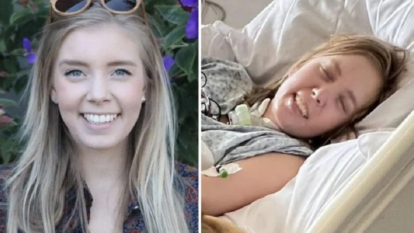 Elég volt egy rossz mozdulat, lebénult a 28 éves nő