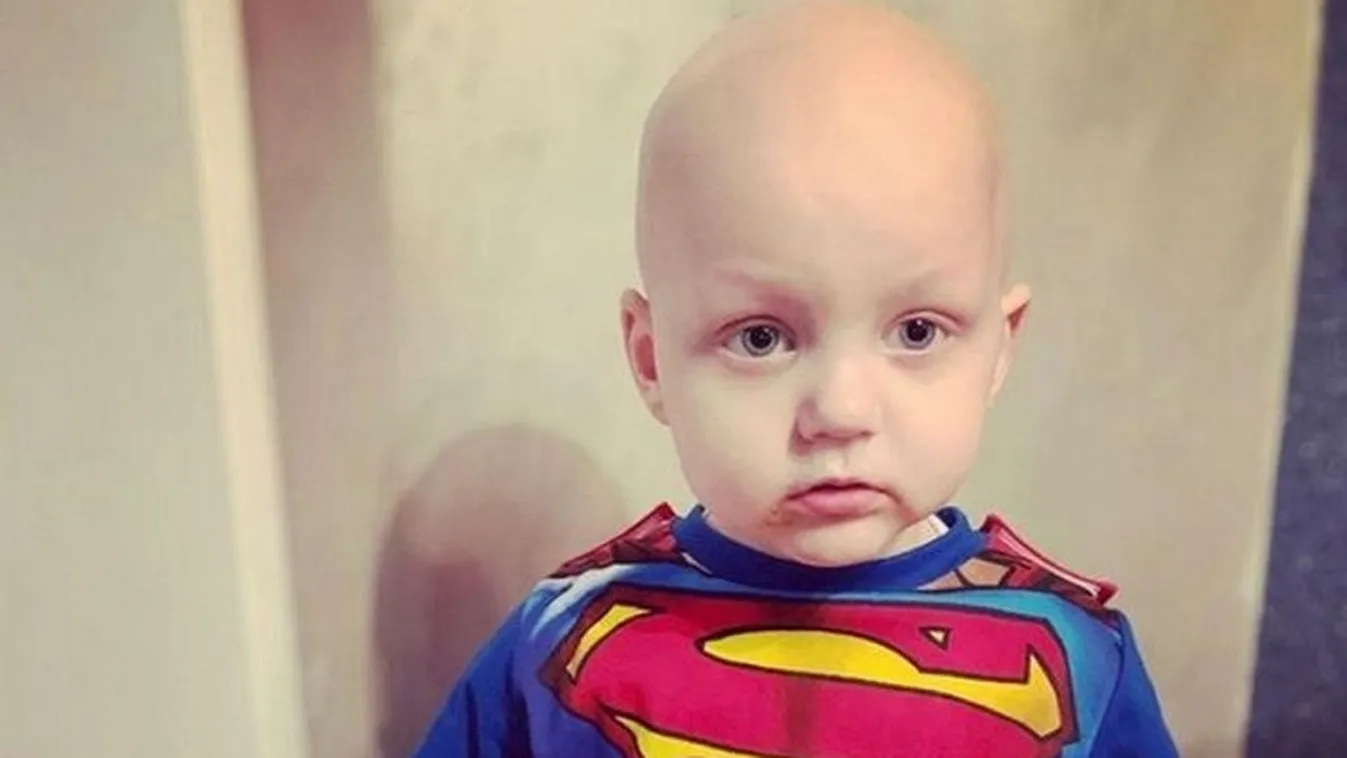 Lélegeztetőgépre került a 4 éves bárányhimlős fiú