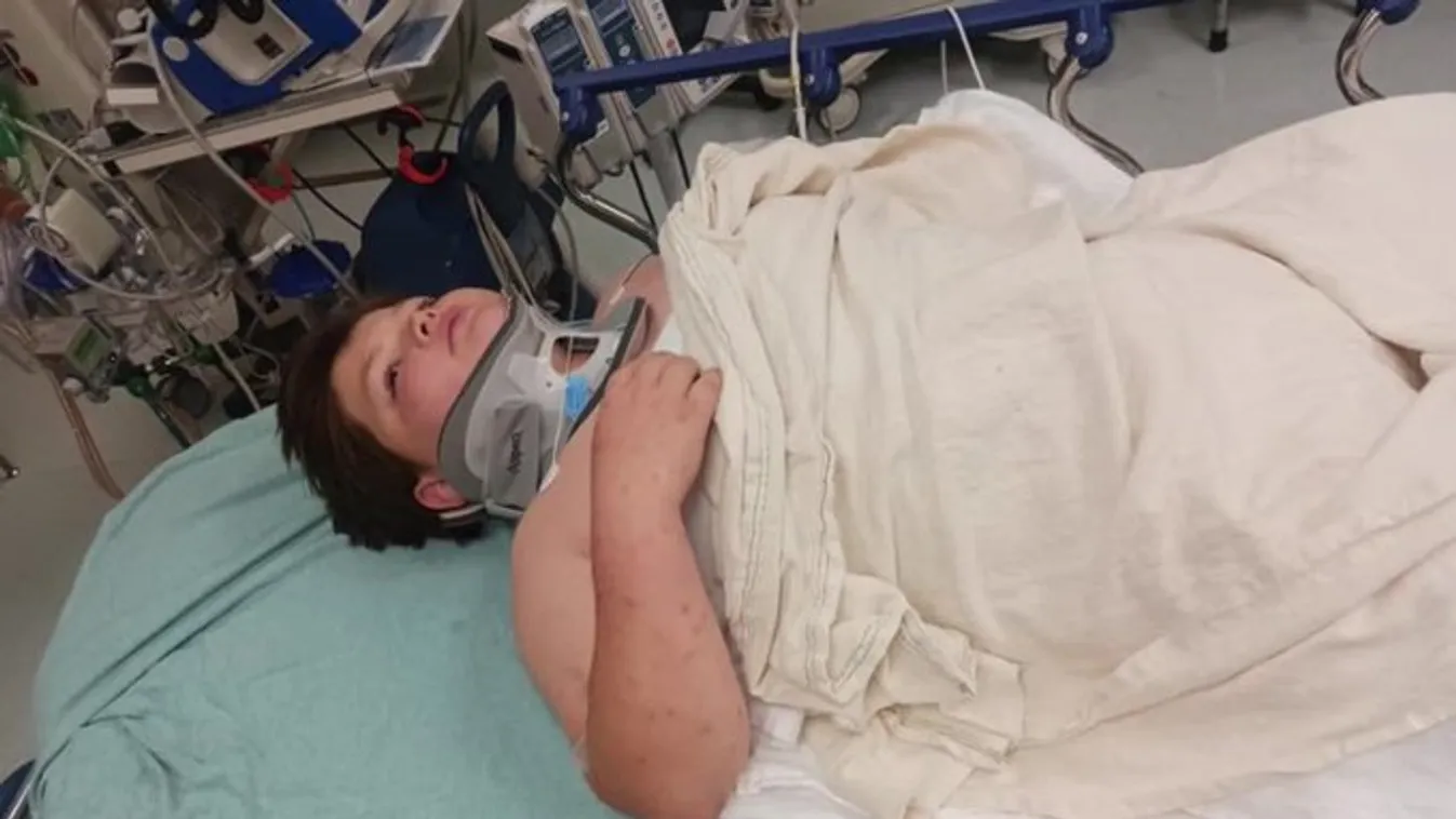 Pokollá vált a kisfiú élete, mégsem adja fel a harcot