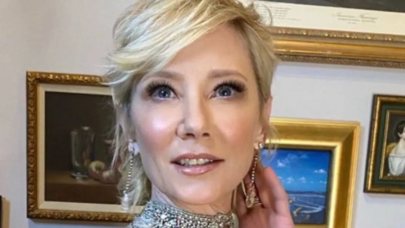  Súlyos autóbalesetet szenvedett a világhírű színésznő, válságos az állapota