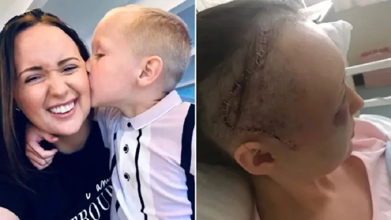 Fogfájással ment orvoshoz Emma