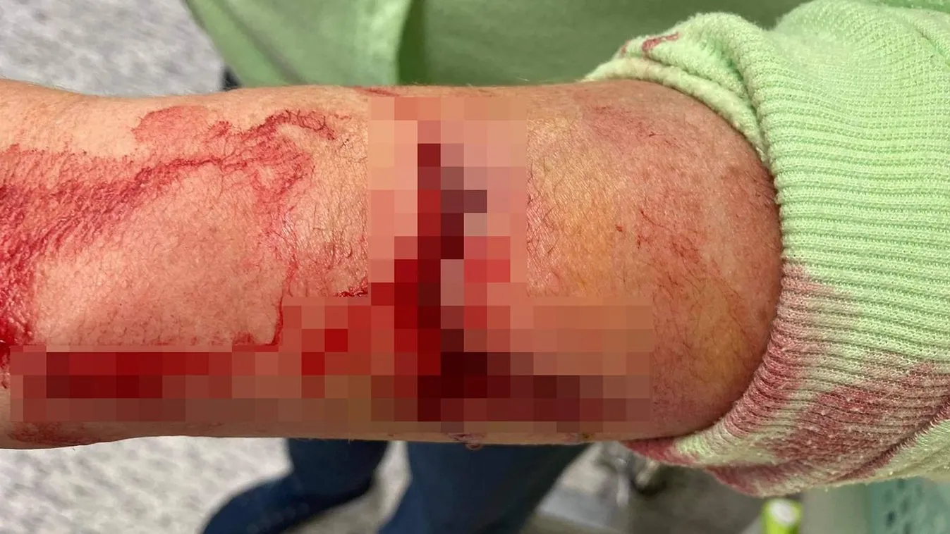 Hajnali horror a szentesi kórházban: Folyt a vér - Fotók