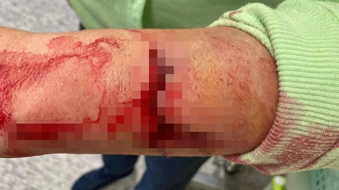 Véres horror a szentesi kórházban