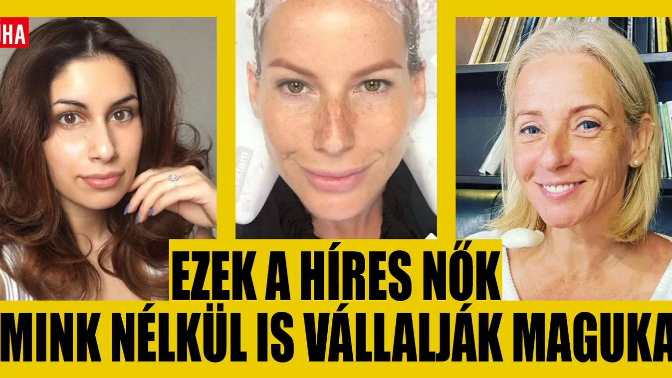 Smink nélkül: Sztárok, akik nem félnek megmutatni az arcukat