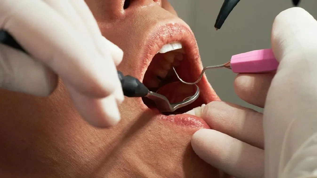 Börtönbe került a horrorfogorvos