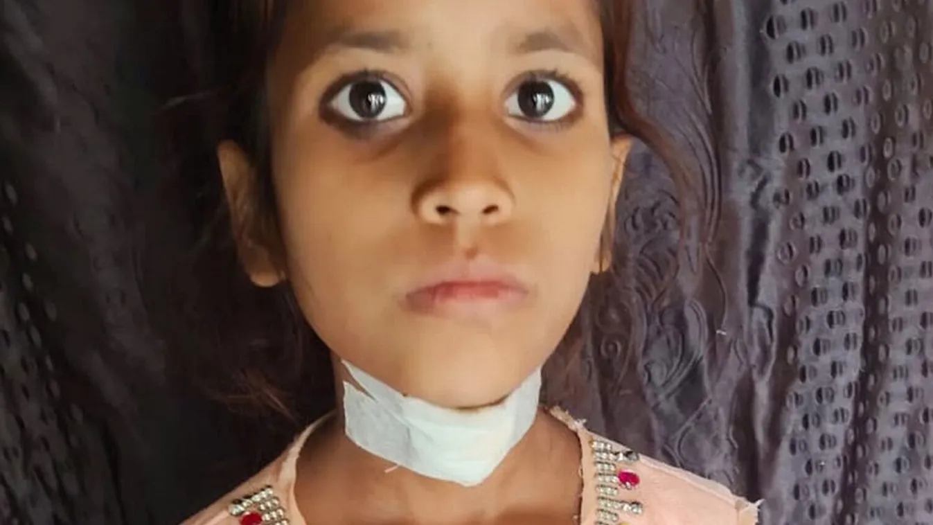 Egy hajszálon múlt a 8 éves kislány élete