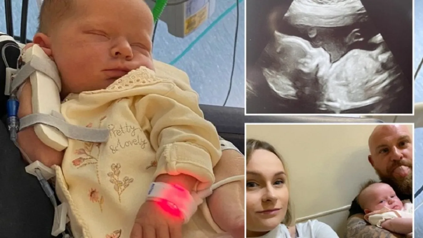 Súlyos szívbetegséggel született az angyalarcú kislány