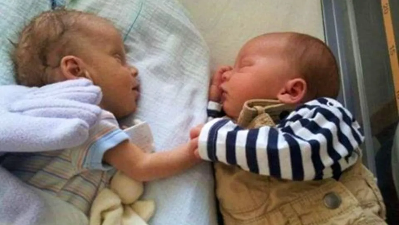 Ikertestvére mellé fektették a haldokló kisbabát