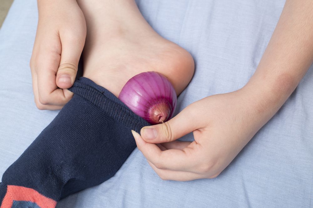 Onion,Slices,In,The,Foot,As,A,Medical,Treatment
