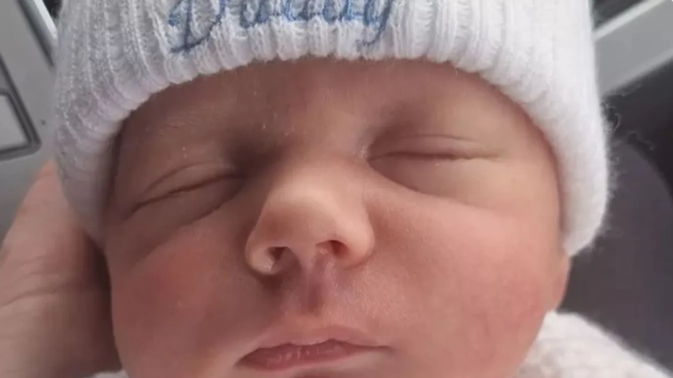 Az anya azt hitte, csak besárgult a kisfia