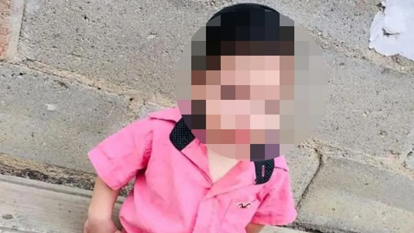 Az életéért küzd a 2 éves kisfiú, lenyelt egy elemet