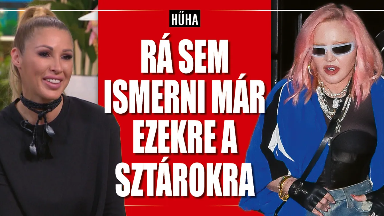 Túltolták a plasztikát? Sztárok, akikre már rá sem ismerünk