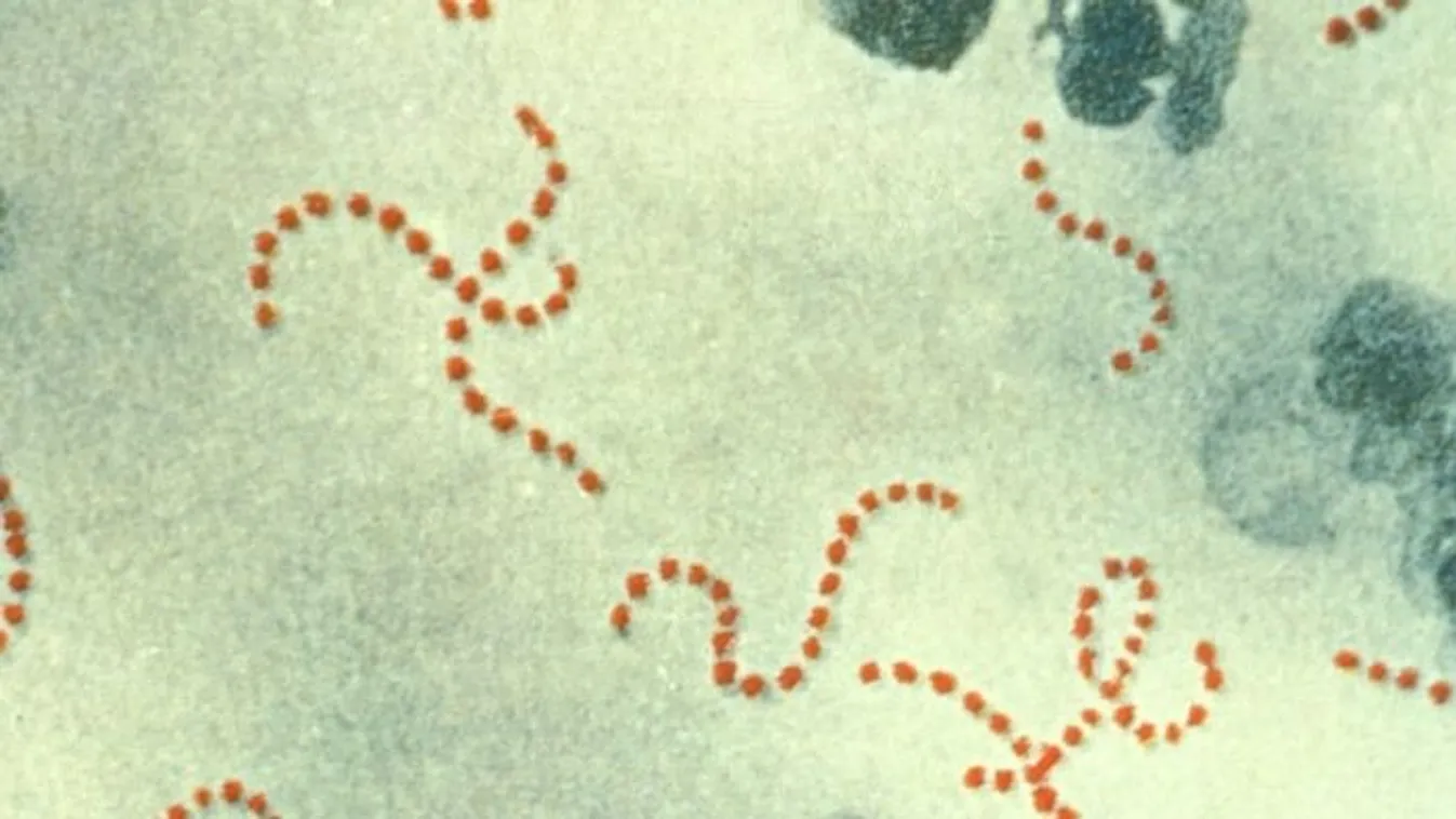 9 kisgyermek halálát okozta egy gyilkos baktérium Angliában