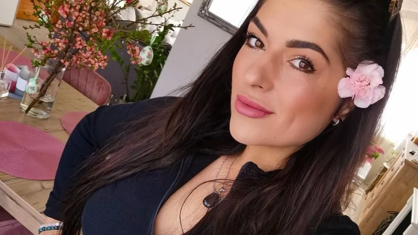 Ez lett a vége Horváth Gréta plasztikai műtétjének - Fotó