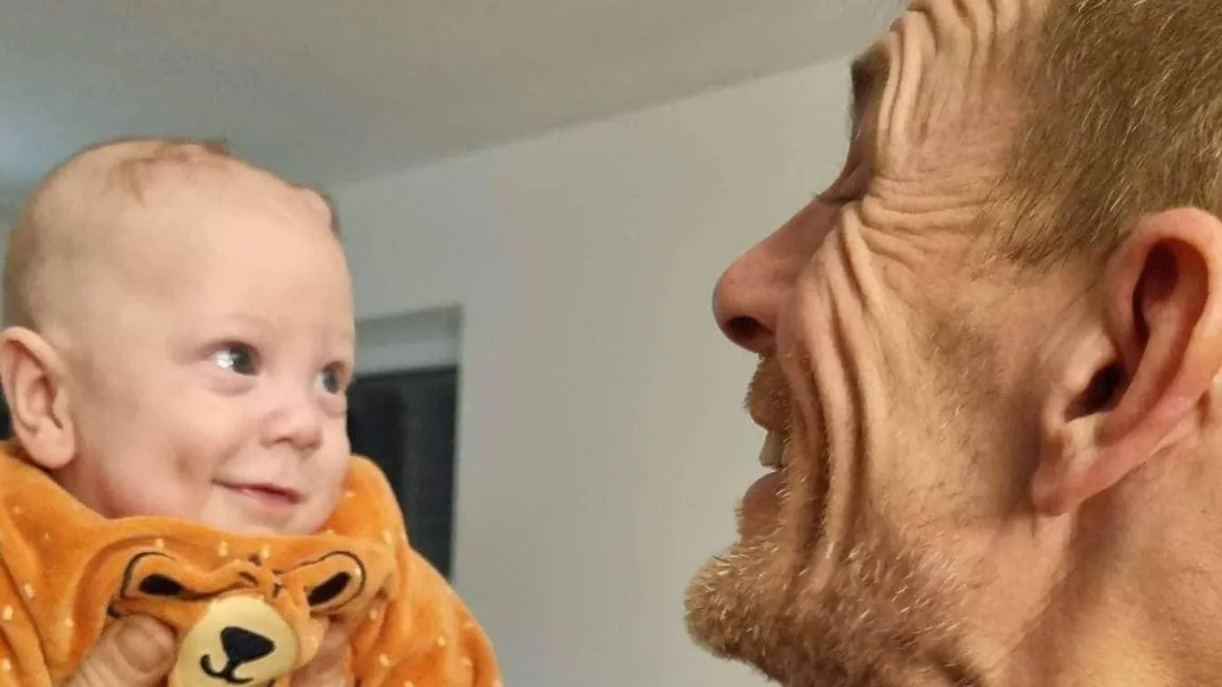 Először ölelhette magához a nyáron élet-halál közt lebegő unokáját a TV2 sztárja - exkluzív fotók