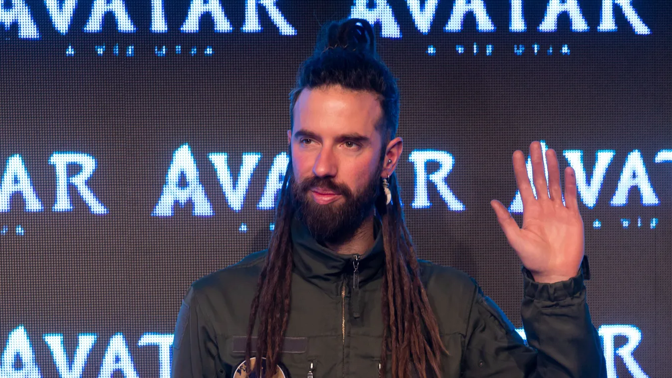 Brutális, mi okozta Varga Viktor fogfájását