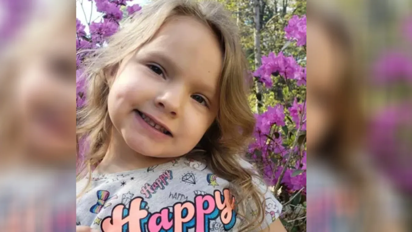 1000 öltéssel kellett összevarrni a kislány arcát