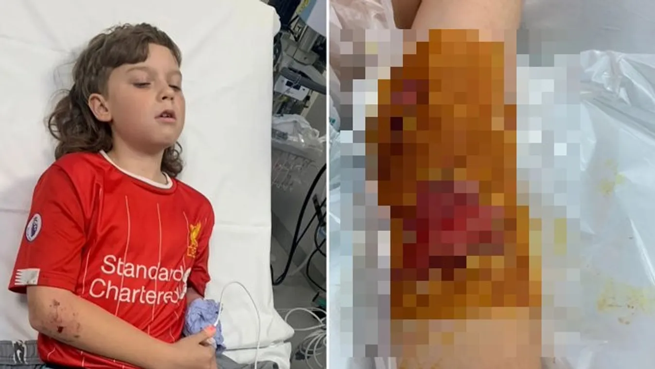 Játék közben támadtak rá a 10 éves kisfiúra