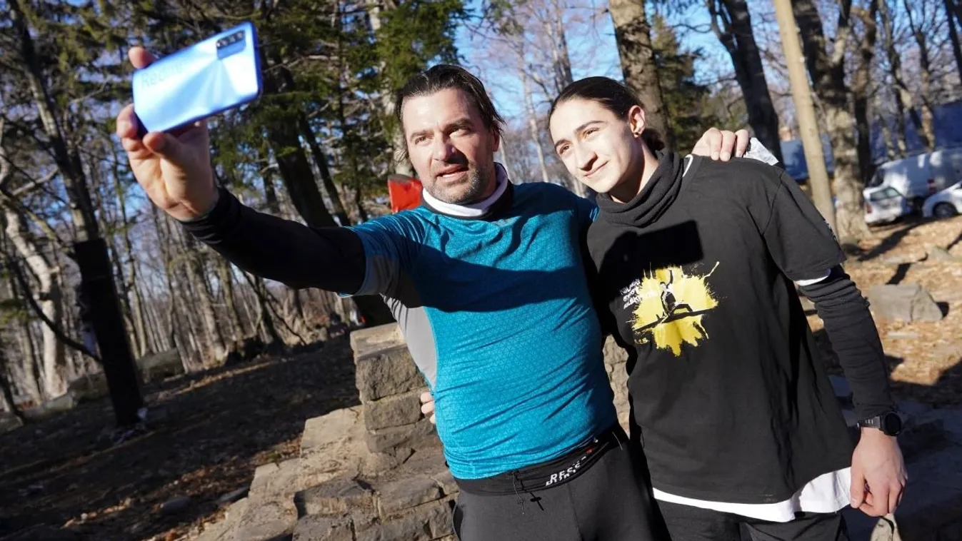 Történetével ad erőt másoknak Soma, a megégett tinédzser