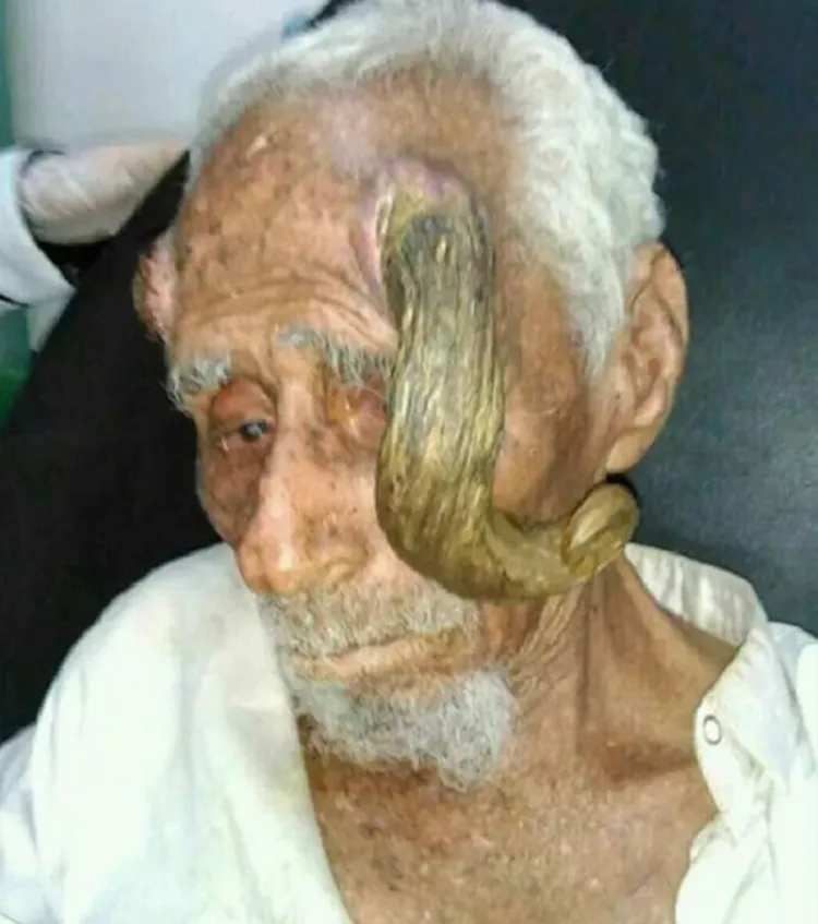 Ali Anter - Kecskeember