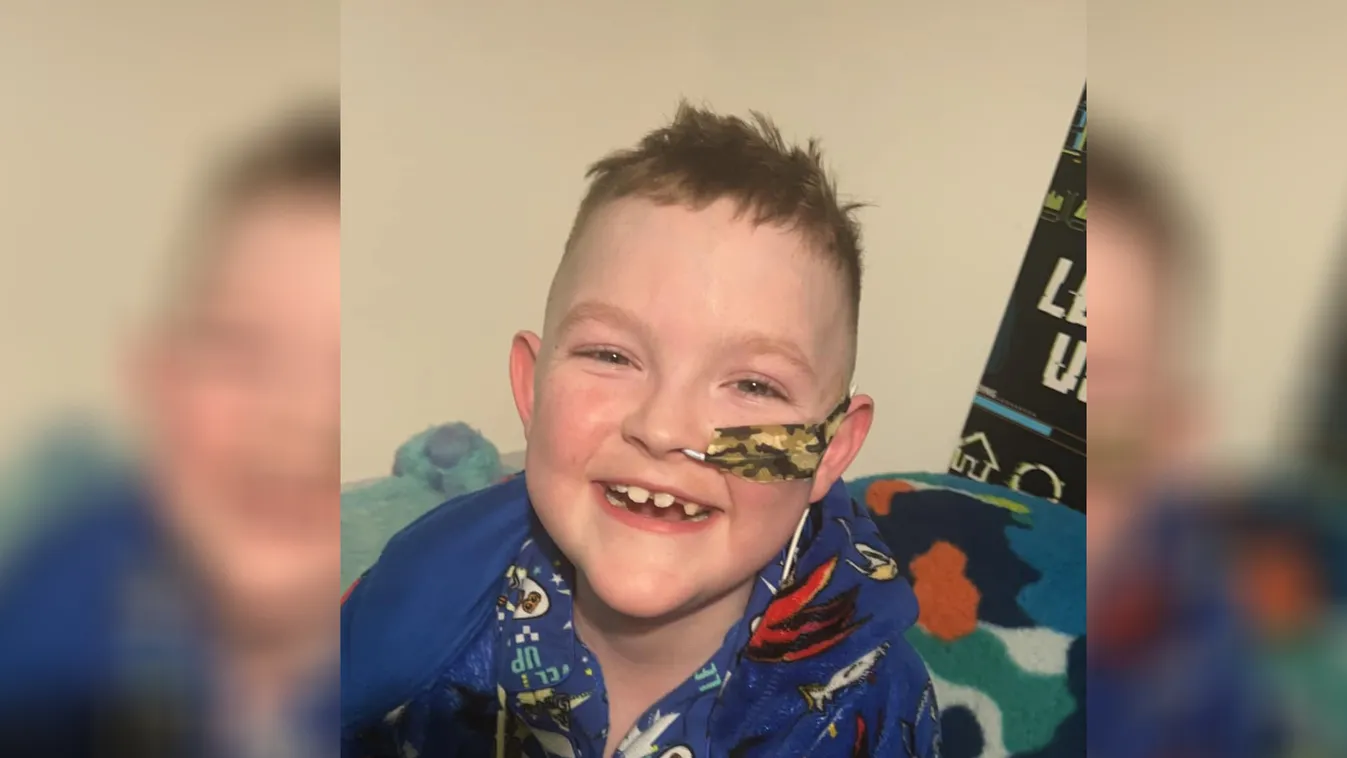 Még a napfényre is allergiás a tündéri kisfiú