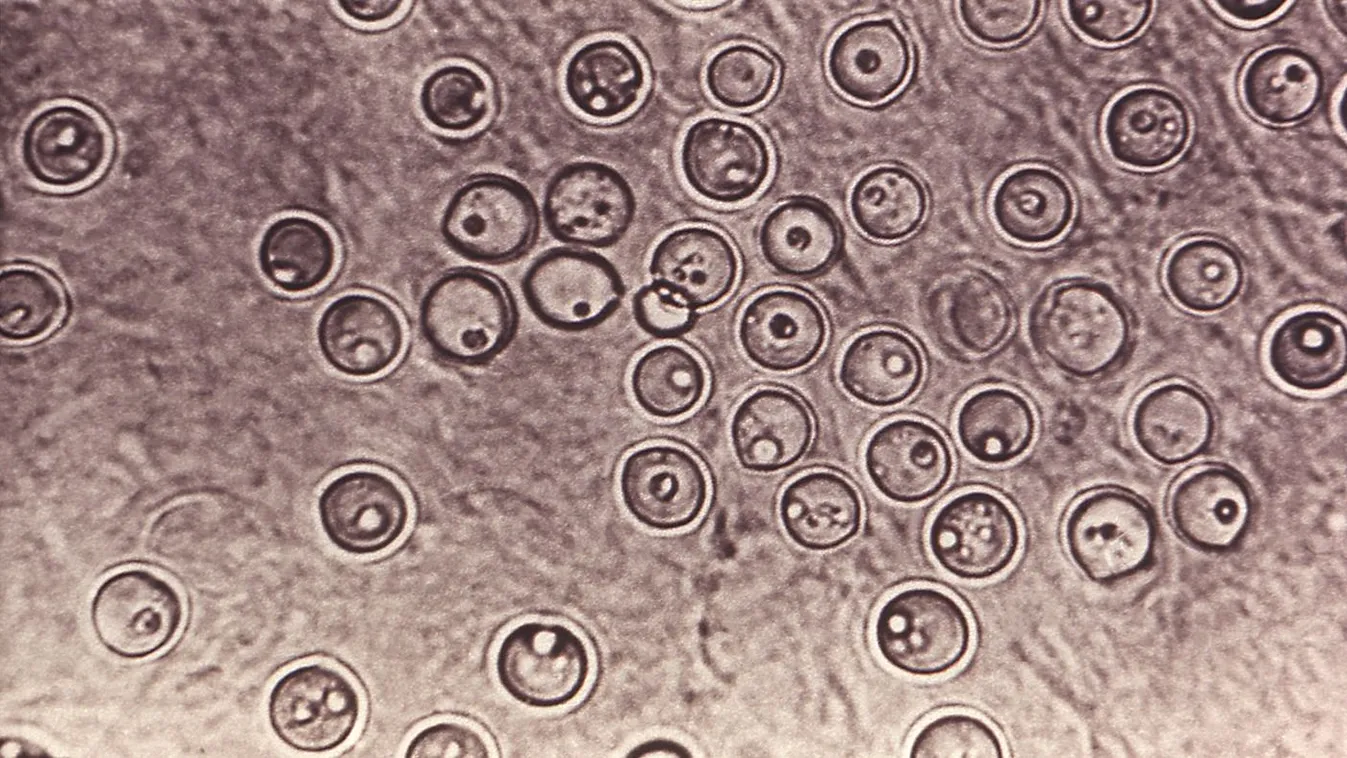 Halálos gombás fertőzés okozott járványt Amerikában