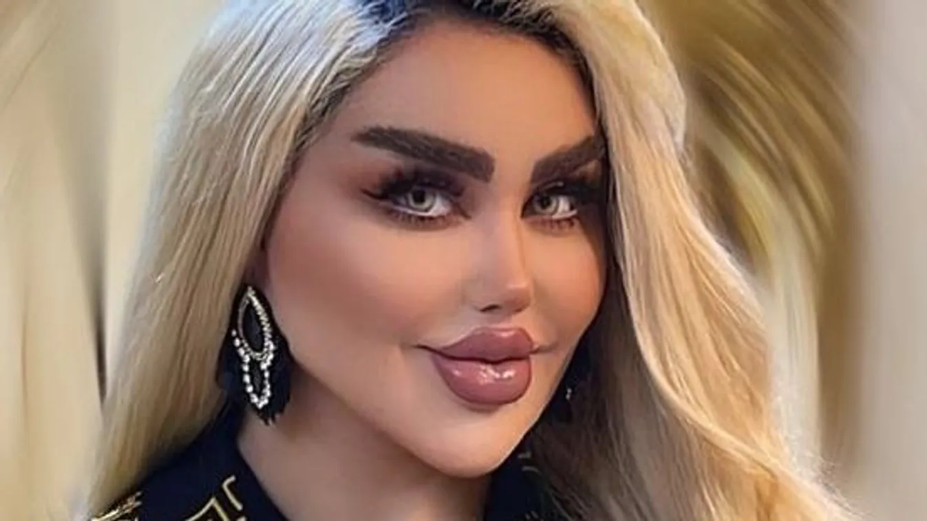 Barbie-vá műttette magát: fel sem ismerni a régi képein