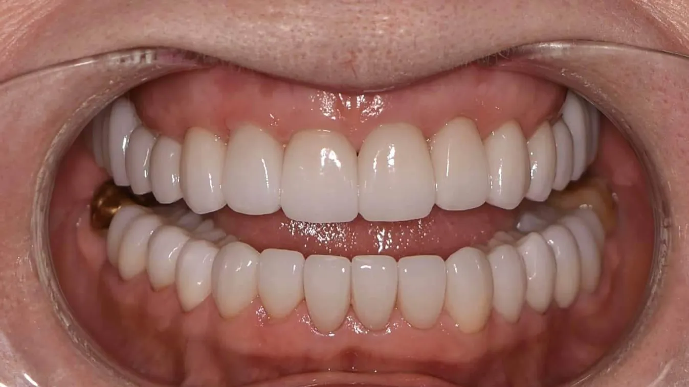 Mosolyogj magabiztosan! (x)