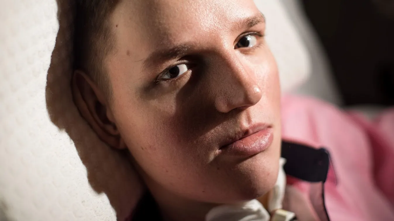  Csoda: Egy ujja mozog csak, de még mindig él Dávid