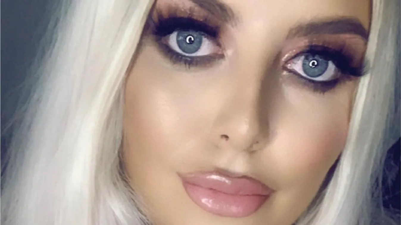 Belehalt a gyomorműtétjébe a 28 éves gyönyörű nő