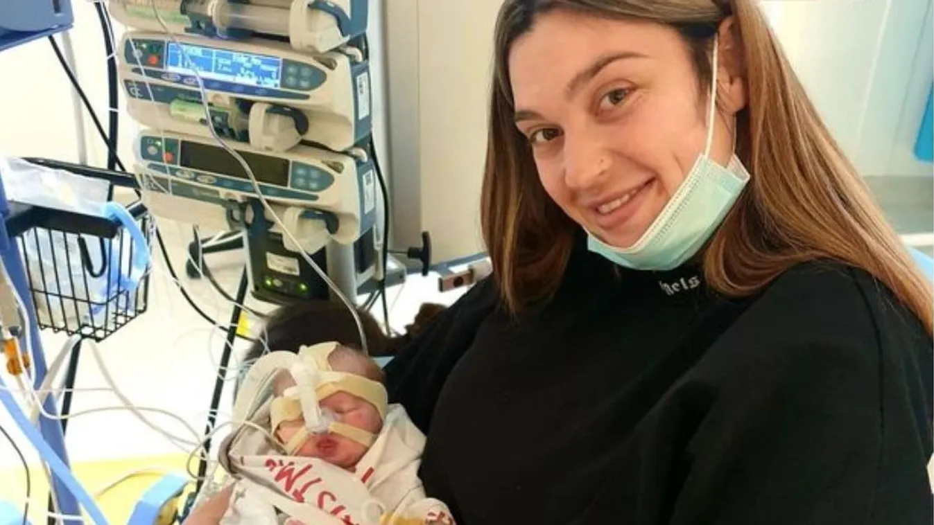 Megállt a szíve a ritka betegséggel diagnosztizált babának