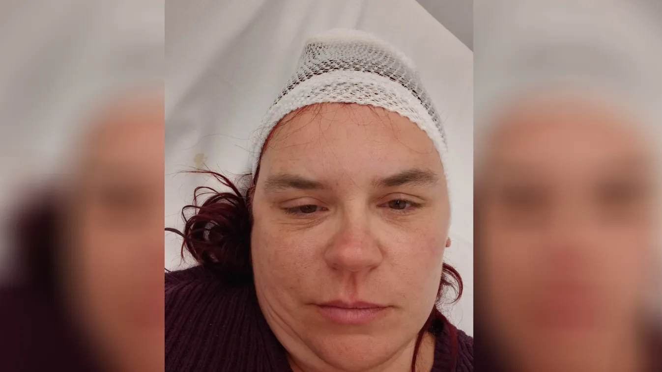 Vasalót vágott hozzá: párja juttatta kórházba Andreát