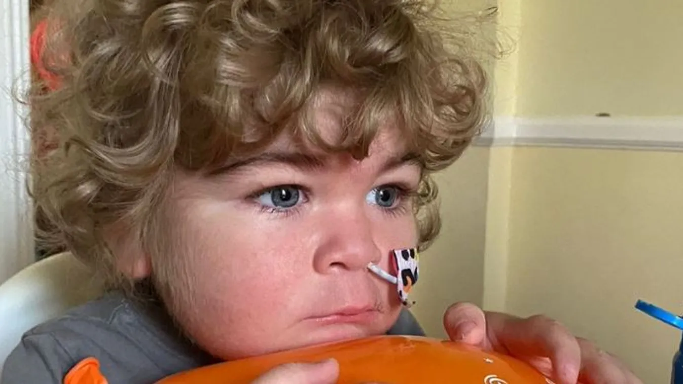 Meghalt egy 3 éves kisfiú, aki elkapta a herpeszvírust