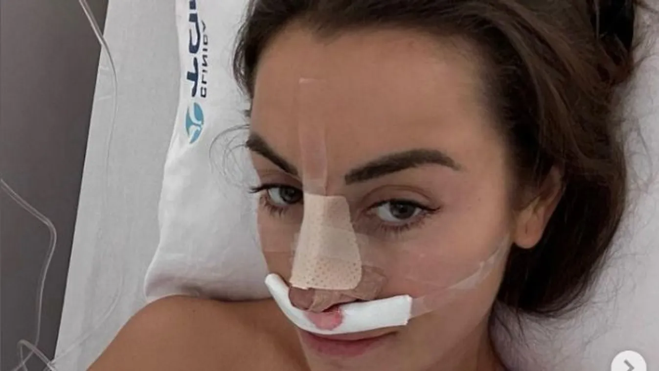 Saját testéből evett az influenszer - Fotók