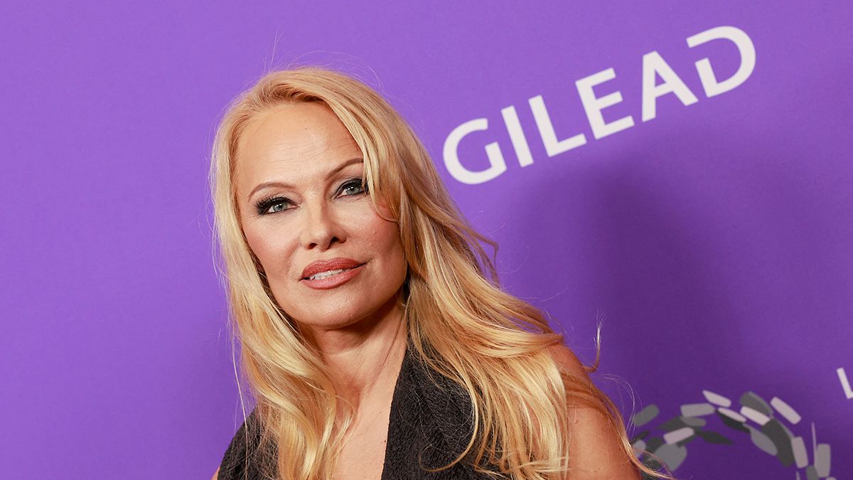  Mi történt Pamela Anderson arcával? Rá sem lehet ismerni