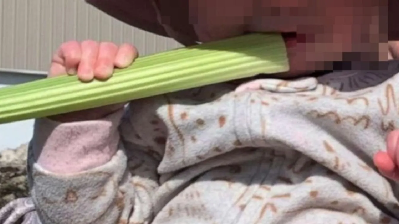 Egy zellertől durván megégett a 7 hónapos kislány szája