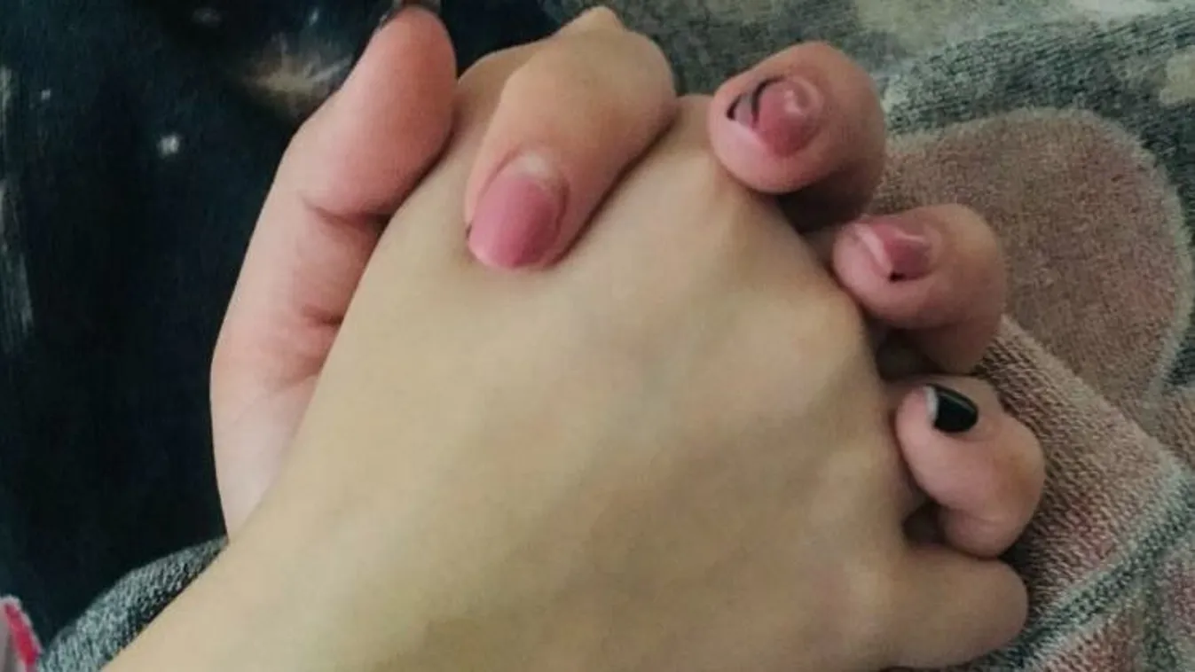 Fotóriporter kollégánk is segít az agykárosult kisfiúnak