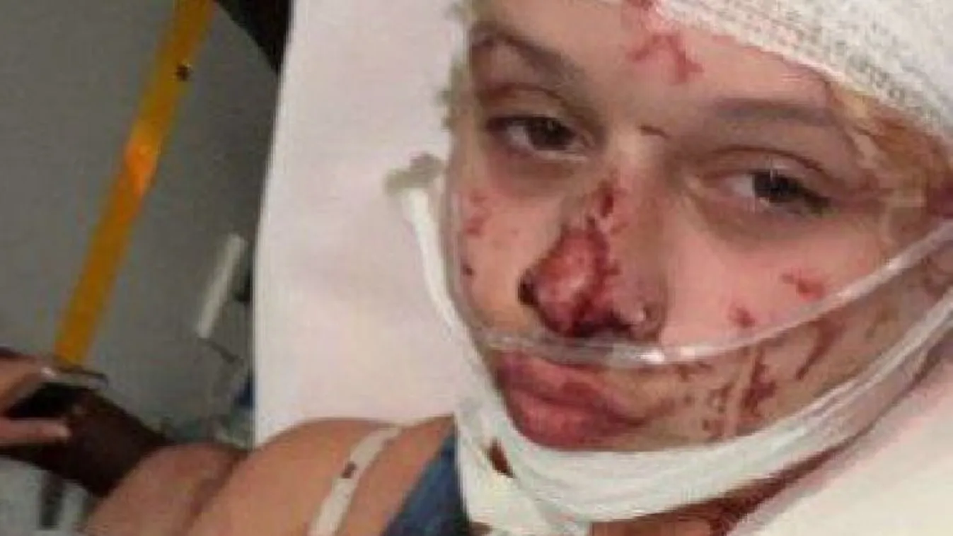 Migránsok vertek össze egy francia modellt a ruhája miatt