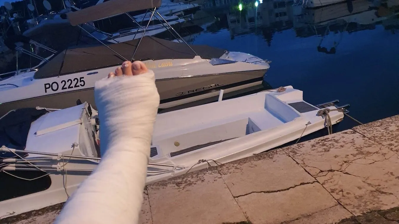 Törött lábbal is szuper élményekben volt része Klaudiának