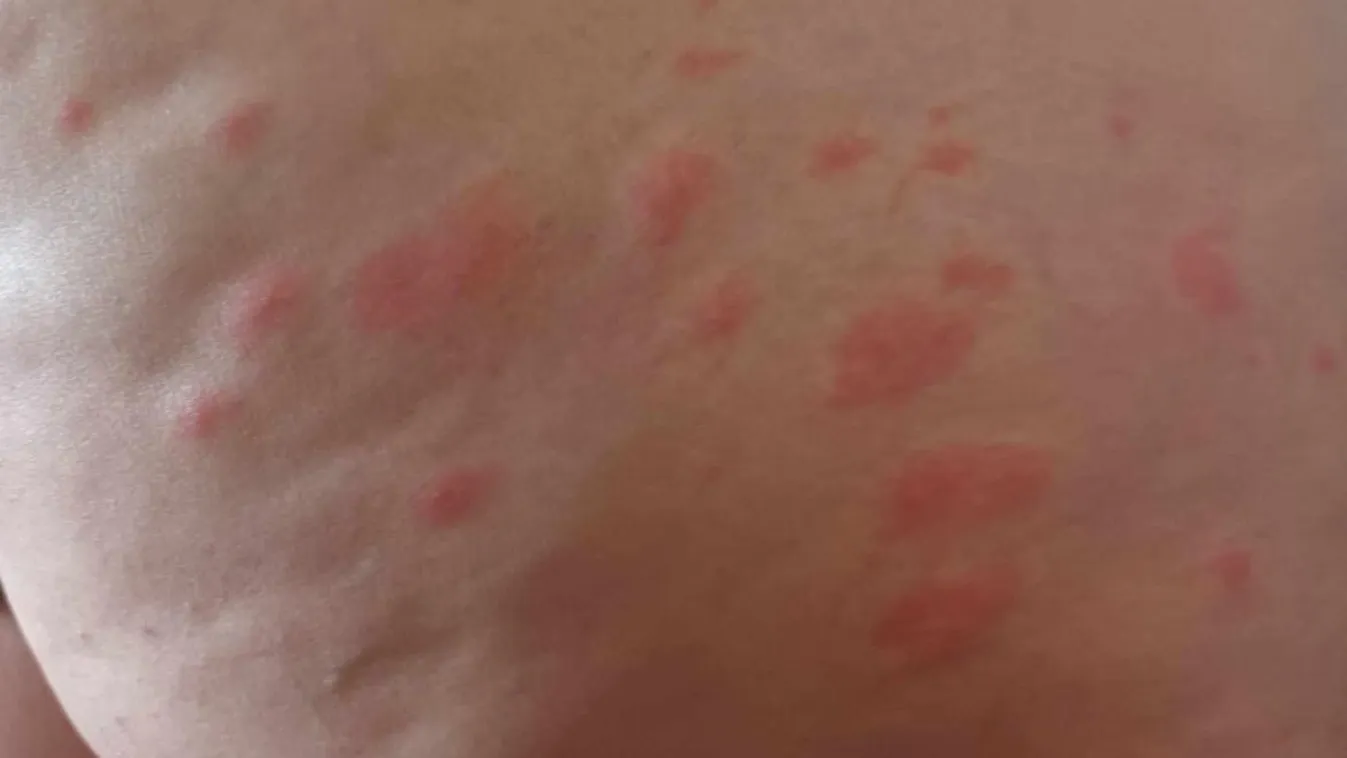 Játszani mentek, sürgősségin kötöttek ki Mónika és gyerekei