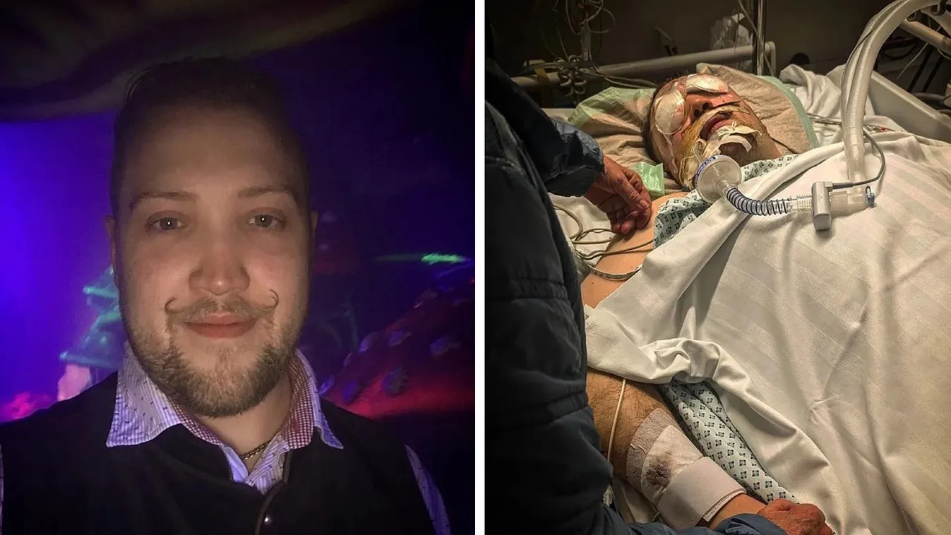 Német fiatalember szemét szúrta ki egy migráns Münchenben