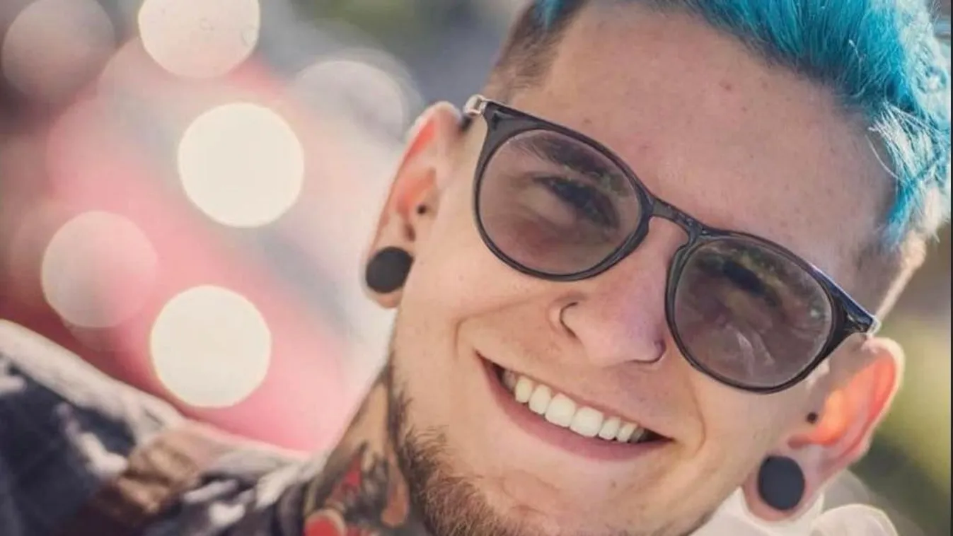 Felháborította az embereket a műlábra gyűjtő Zoli története