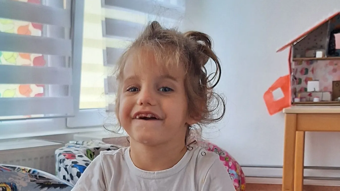 Hatévesen lett kollégista a halva született Dorci